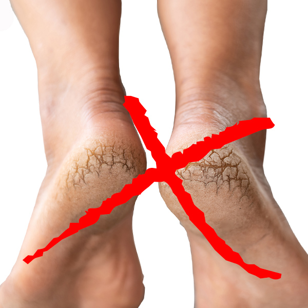 Cracked heels treatment with coconut husk brush